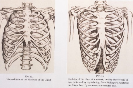 Corset Ribcage Deformation